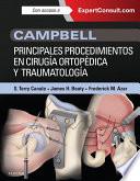 libro Campbell. Principales Procedimientos En Cirugía Ortopédica Y Traumatología + Expertconsult