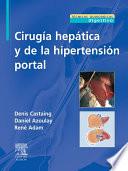 libro Cirugía Hepática Y De La Hipertensión Portal