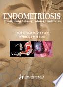 libro Endometriosis: Tratamiento Actual Y Futuras Tendencias