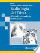 libro Radiología Del Tórax