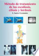libro Método De Tratamiento De Las Escoliosis, Cifosis Y Lordosis